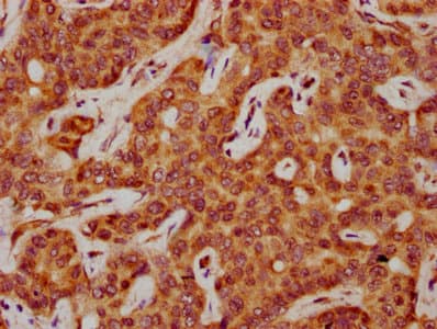 SAA2 / Serum Amyloid A2 Antibody
