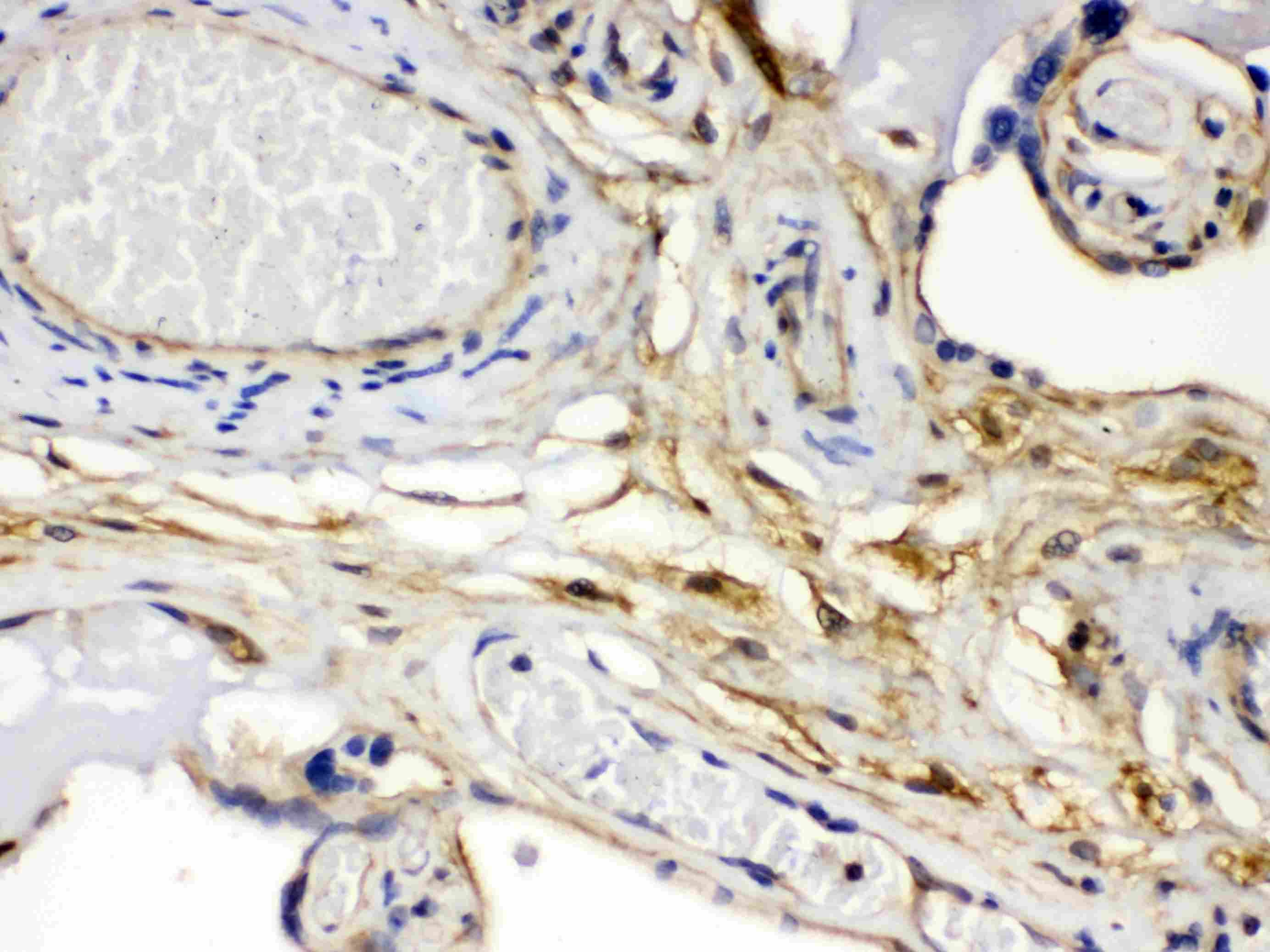 FGF1 / Acidic FGF Antibody