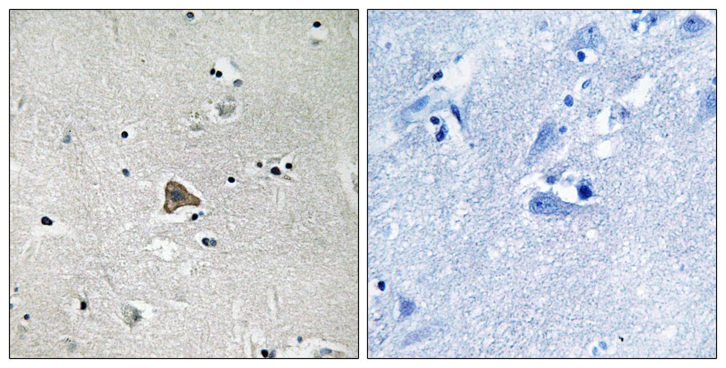 CLDN4 / Claudin 4 Antibody (Ab-208)