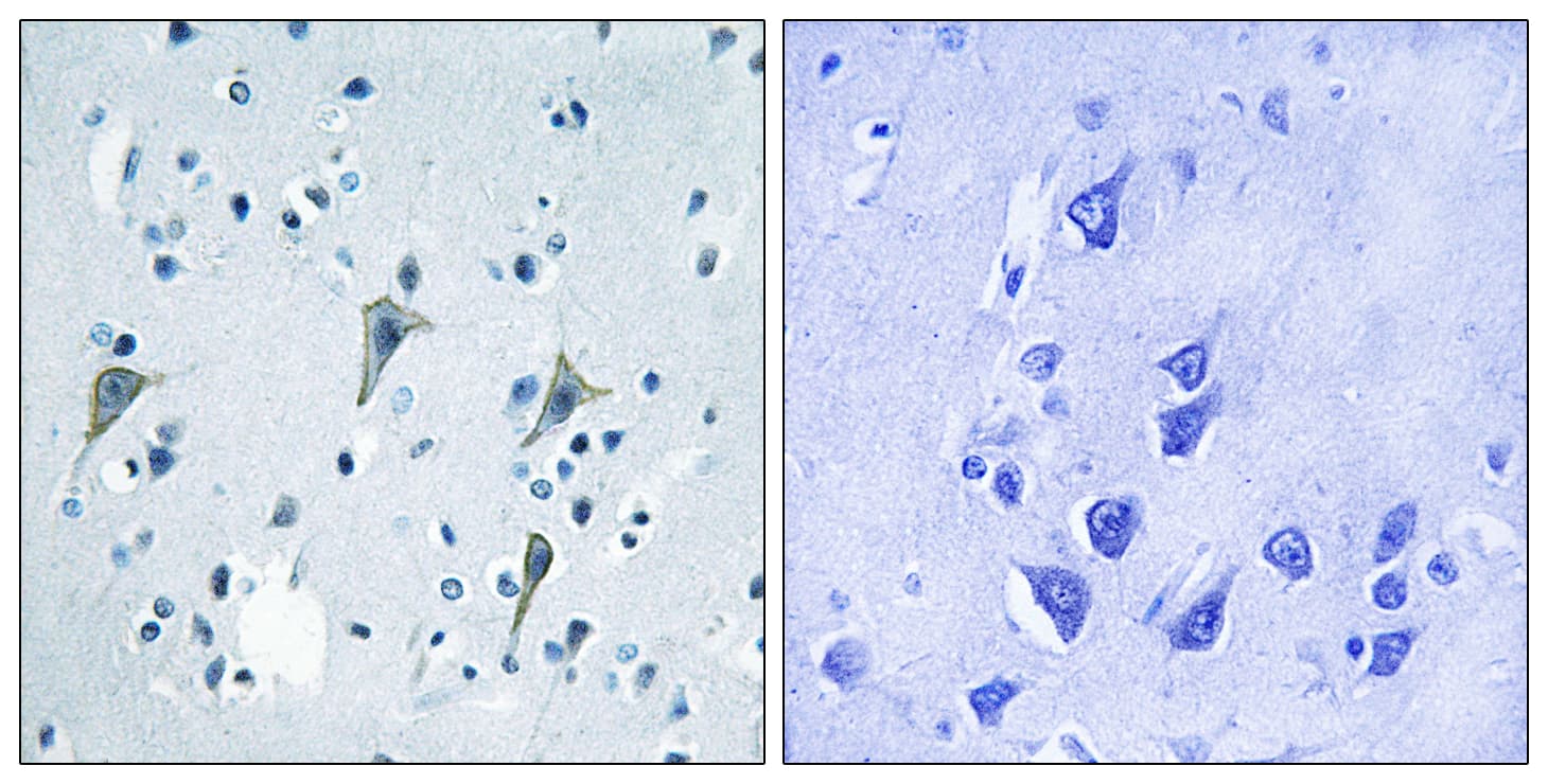 SREB / GPR85 Antibody (aa181-230)