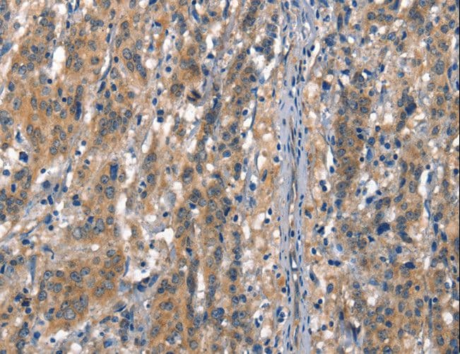 CD144 / CDH5 / VE Cadherin Antibody
