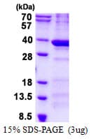 Human BCDIN3D Protein (Recombinant His)