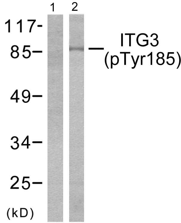 ITGB3 / Integrin Beta 3 / CD61 Antibody (phospho-Tyr785)