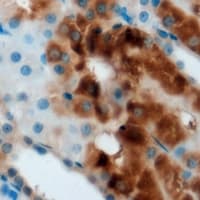 FDPS Antibody