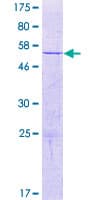 Human CCDC127 Protein (Recombinant GST)