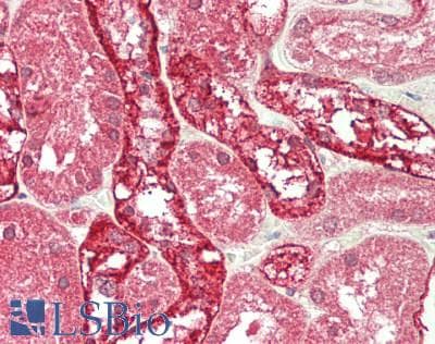 IHC-plus™ Raptor / Mip1 Antibody (aa1-50)