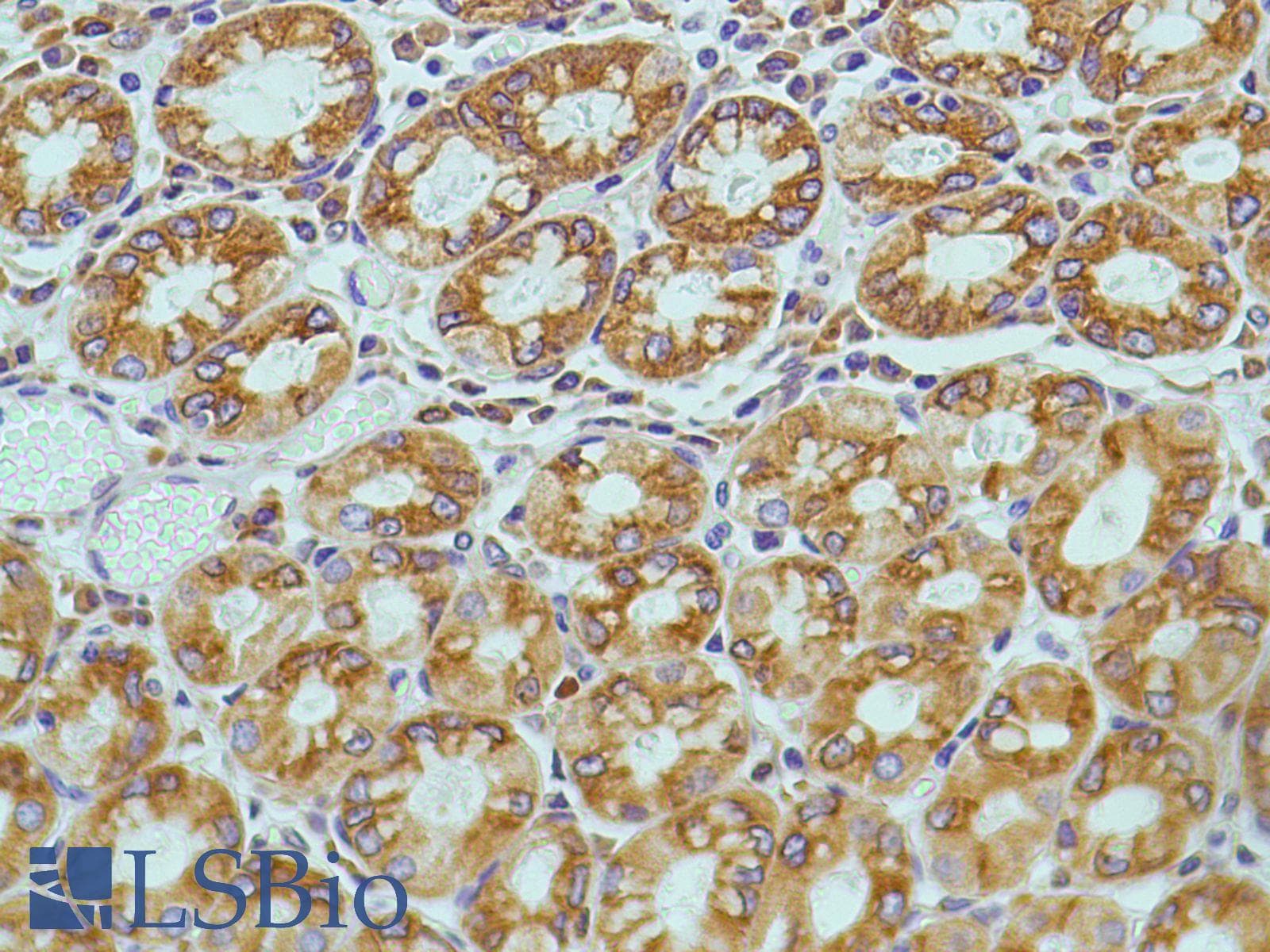 PTGS2 / COX2 / COX-2 Antibody (C-Terminus, clone SP21)