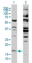 IHC-plus™ Histone H3.3 Antibody (clone 2D7-H1)