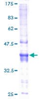 Human NDUFAF5 Protein (Recombinant GST)
