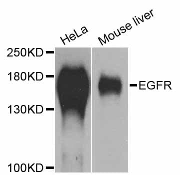 EGFR Antibody