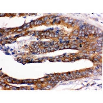Polyclonal Rabbit anti-Human RENT1 / UPF1 Antibody (aa578-614, IHC, WB)