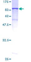 Human MPP2 Protein (Recombinant GST)