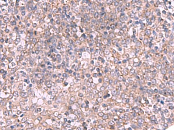 Polyclonal Rabbit anti-Human ECSIT Antibody (IHC, WB)