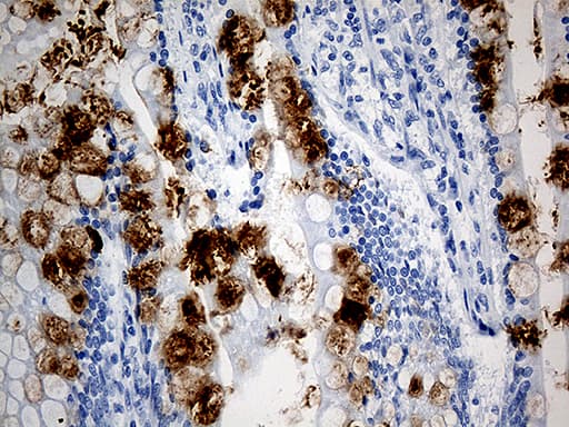TFF1 / pS2 Antibody (aa25-84, clone OTI1F5)