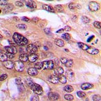 RELA / NFKB p65 Antibody (C-Terminus)