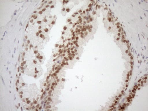 Monoclonal Mouse anti-Human MGMT Antibody (clone OTI2F10, Carrier-free, IHC, WB)