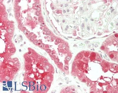 IHC-plus™ GSS / Glutathione Synthetase Antibody