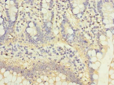 C5orf22 Antibody