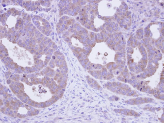CCT5 / TCP1 Epsilon Antibody (aa1-264)