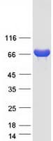Human PADI1 Protein (Recombinant Myc-DDK (Flag))