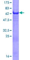 Human PHLDA1 Protein (Recombinant GST)
