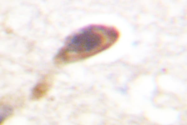 CAMK4 / CaMK IV Antibody (Val192/196)