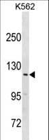 Polyclonal Rabbit anti-Human HERC3 Antibody (aa51-77, WB)