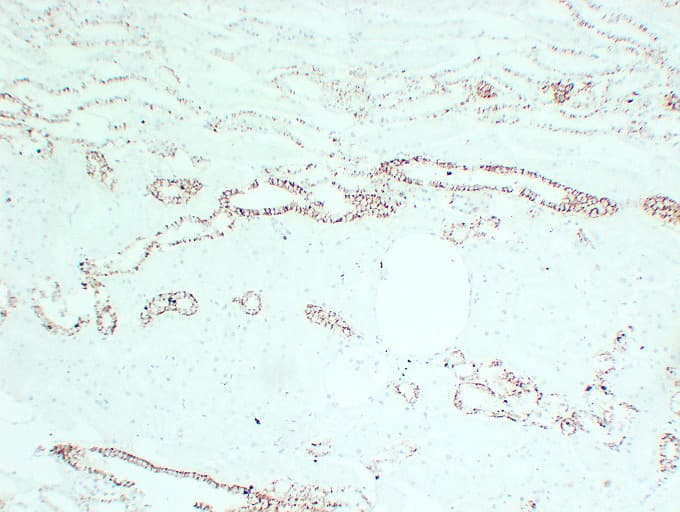 CLDN7 / Claudin 7 Antibody (clone ABT-CLD7)