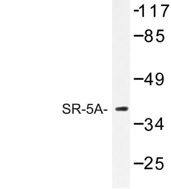 HTR5A / 5-HT5A Receptor Antibody (Pro241)