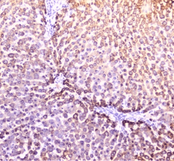 PON1 / ESA Antibody