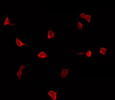 Polyclonal Rabbit anti-Human G Protein-coupled Receptor US28 (HHRF3) [Cytomegalovirus] Antibody (IF, WB)
