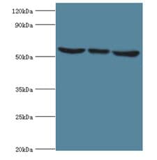 MAPK15 / ERK7 Antibody (aa1-95)