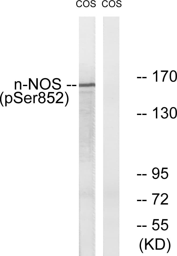 NOS1 / nNOS Antibody (phospho-Ser852)