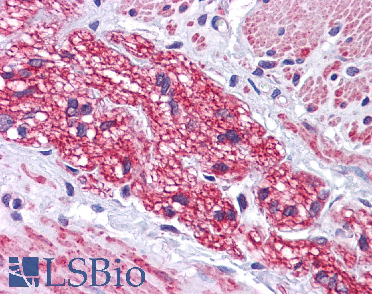 IHC-plus™ Polyclonal Rabbit anti-Human SIP1 Antibody (IHC, IF, WB)