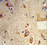 Polyclonal Rabbit anti-Human DSTN / Destrin Antibody (aa70-98, IHC, WB)