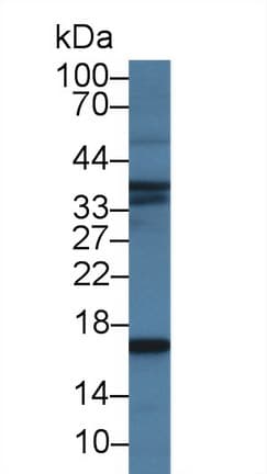 NPPB / BNP Antibody (clone C11)