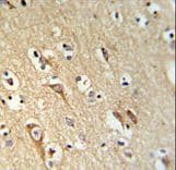 ALG10 / KCR1 Antibody (aa17-43)