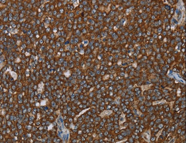Polyclonal Rabbit anti-Human GCKR Antibody (IHC)