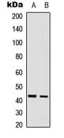 CDCA7 Antibody (Internal)