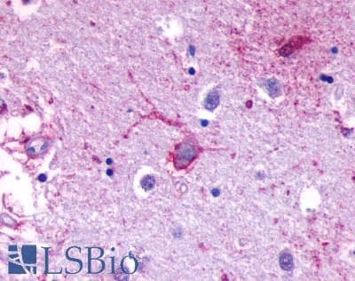 PathPlus™ ADGRF1 / GPR110 Antibody (N-Terminus)