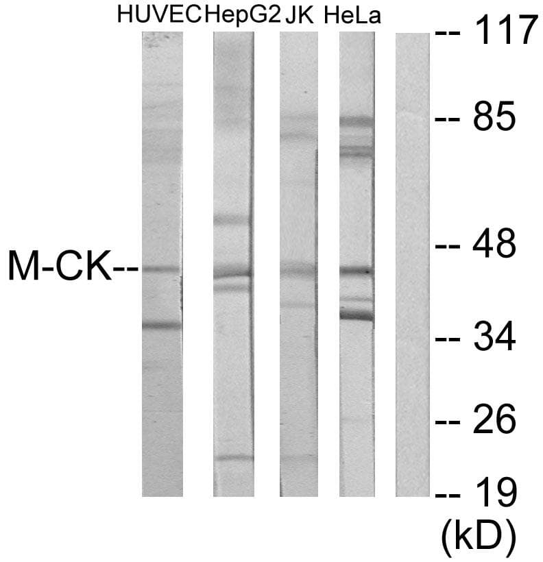 CKM / Creatine Kinase MM Antibody