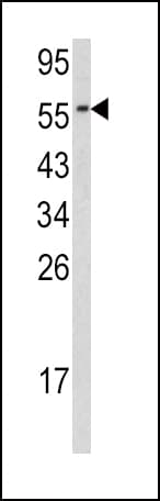 Polyclonal Rabbit anti-Human CDC23 Antibody (aa140-168, IHC, WB)