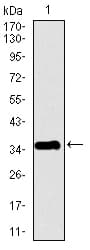 PPY / Pancreatic Polypeptide Antibody (clone 2G5D12)