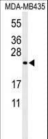ZCCHC24 Antibody (aa136-165)