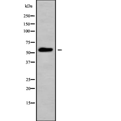 SLC16A5 / MCT5 Antibody