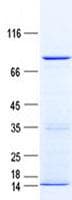 Human CACNB2 Protein (Recombinant His, N-Terminal)
