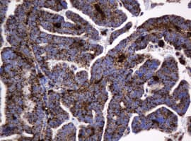 GLB1 / Beta-Galactosidase Antibody (clone OTI1C9)