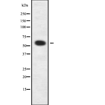 ETNPPL / AGXT2L1 Antibody
