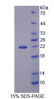 Mouse HIBCH Protein (Recombinant)