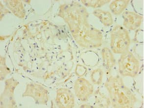 SULT1C2 / Sulfotransferase 1C2 Antibody (aa1-120)